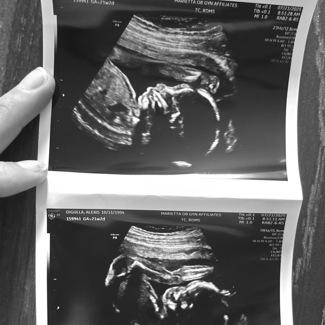 Photo shared by Alexis for their Babylist baby registry.
