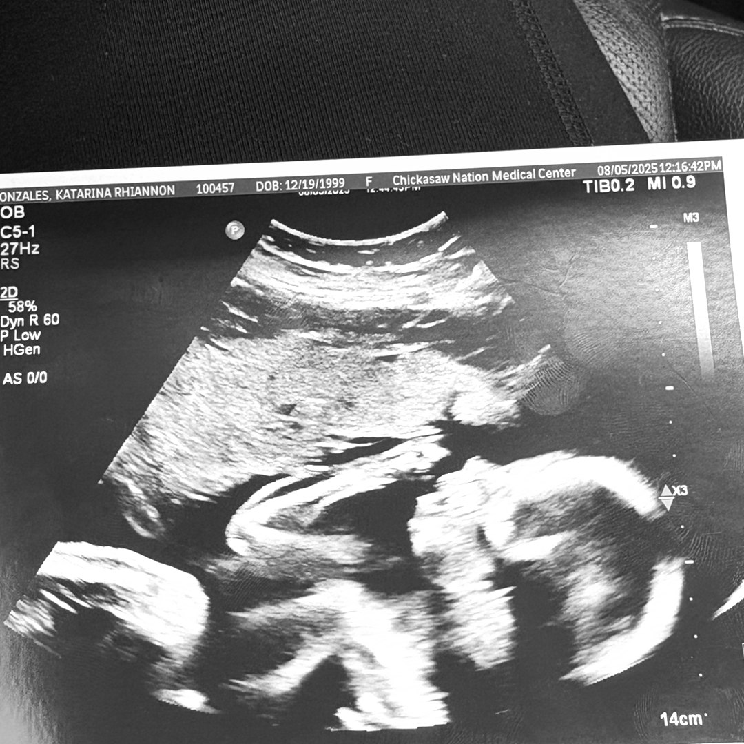 Photo shared by Katarina for their Babylist baby registry.