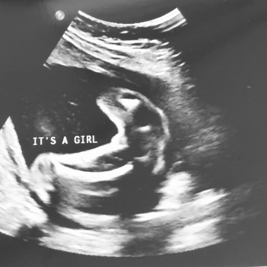Photo shared by Katarina for their Babylist baby registry.