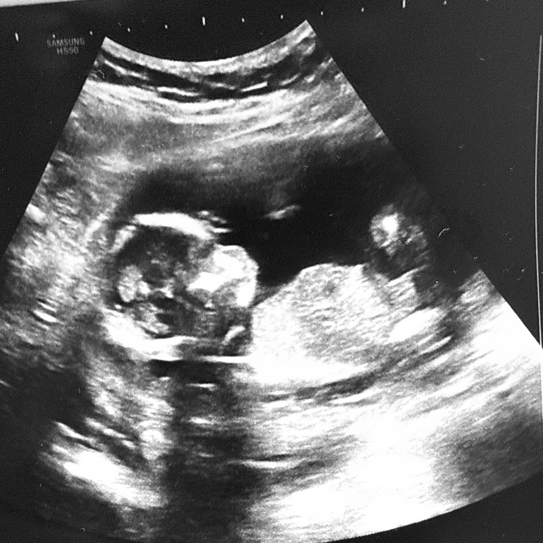 Photo shared by Mariah for their Babylist baby registry.