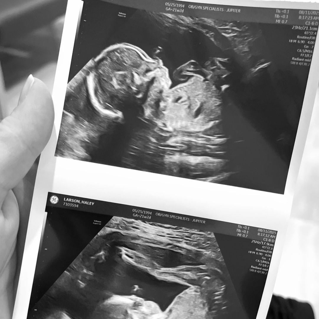 Photo shared by Haley for their Babylist baby registry.