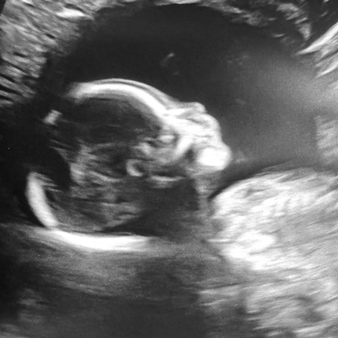 Photo shared by Chasity for their Babylist baby registry.
