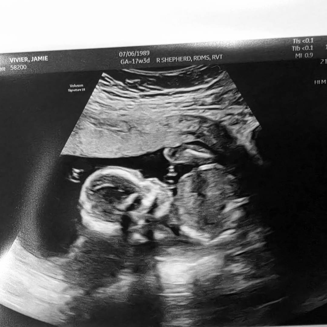 Photo shared by Jamie for their Babylist baby registry.