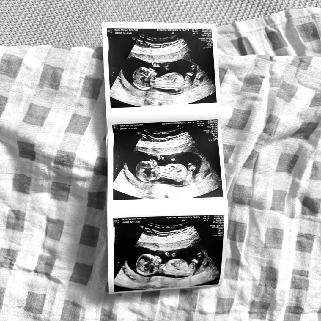Photo shared by Morgan for their Babylist baby registry.