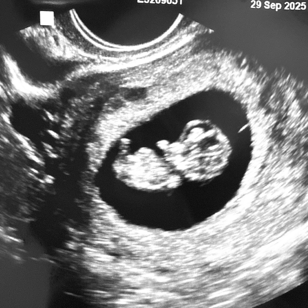 Photo shared by Rebecca for their Babylist baby registry.