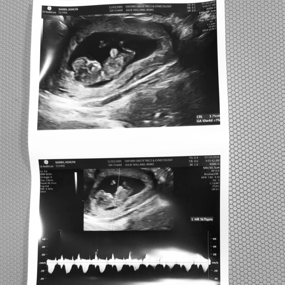 Photo shared by Ashlyn for their Babylist baby registry.