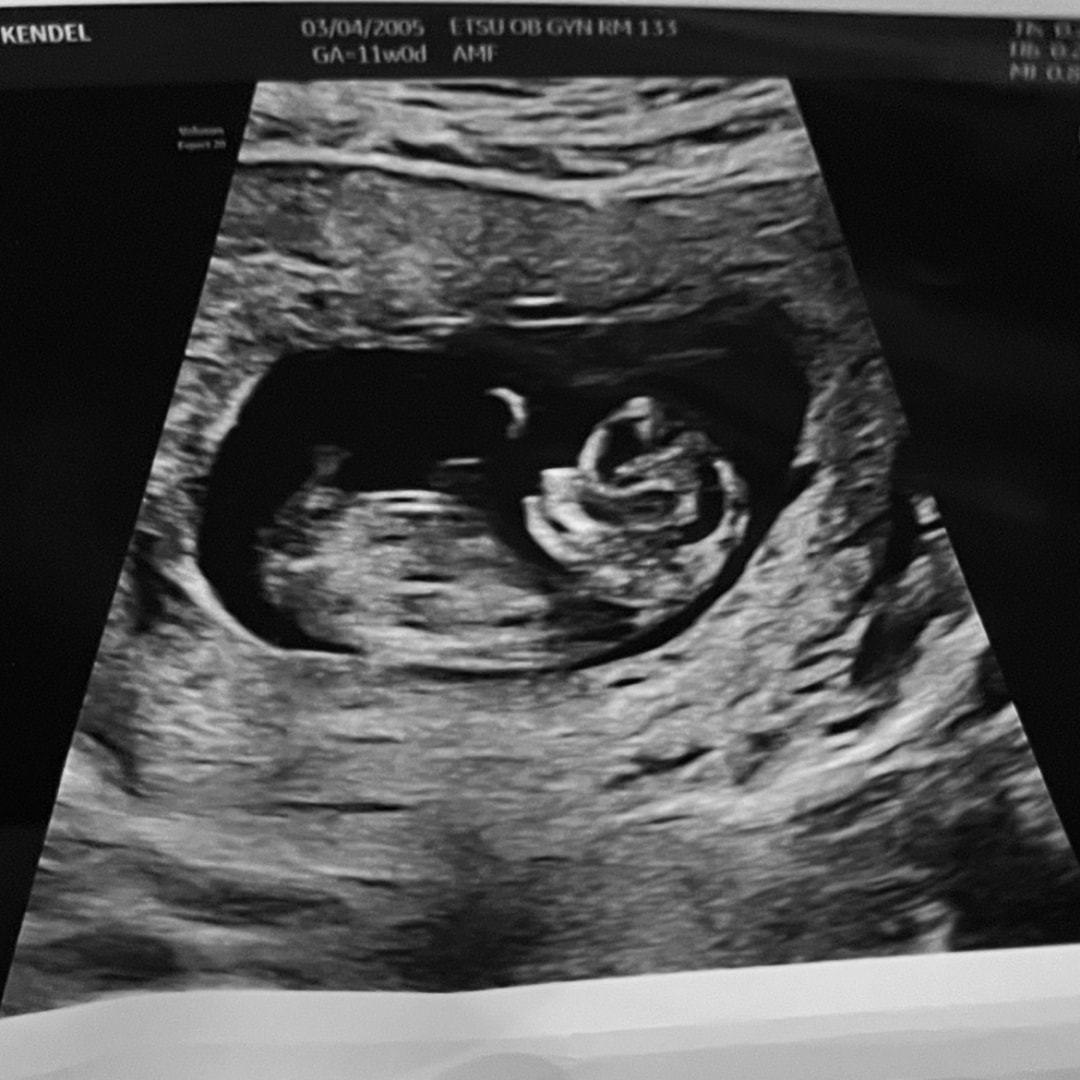 Photo shared by Kendel for their Babylist baby registry.