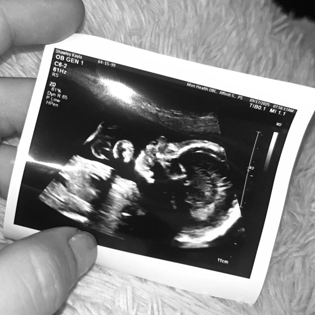 Photo shared by Kayla for their Babylist baby registry.