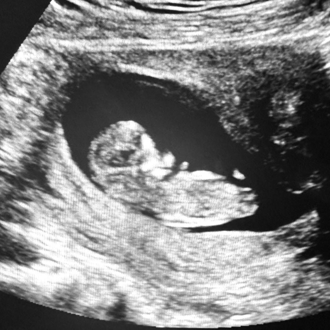 Photo shared by Ashlyn for their Babylist baby registry.
