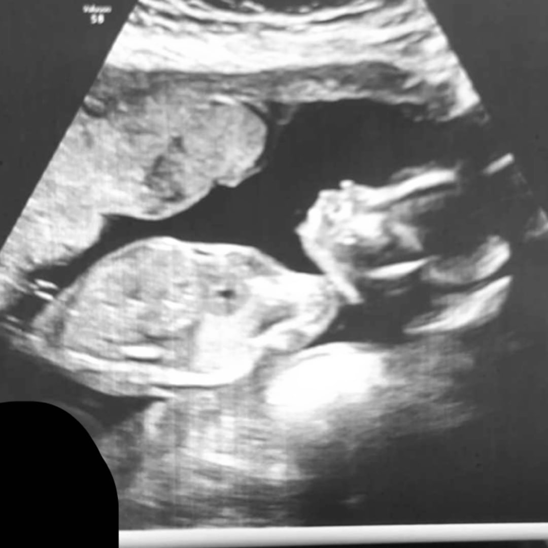 Photo shared by Shaley for their Babylist baby registry.