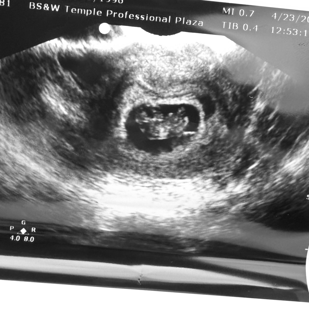 Photo shared by Jordan for their Babylist baby registry.