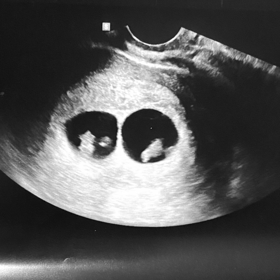 Photo shared by Colleen for their Babylist baby registry.