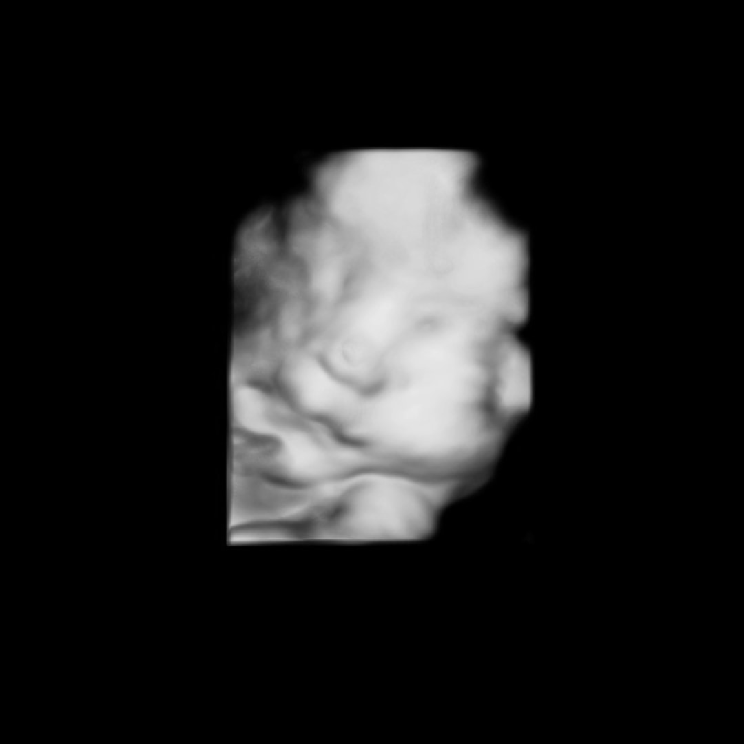 Photo shared by Mackenzie for their Babylist baby registry.