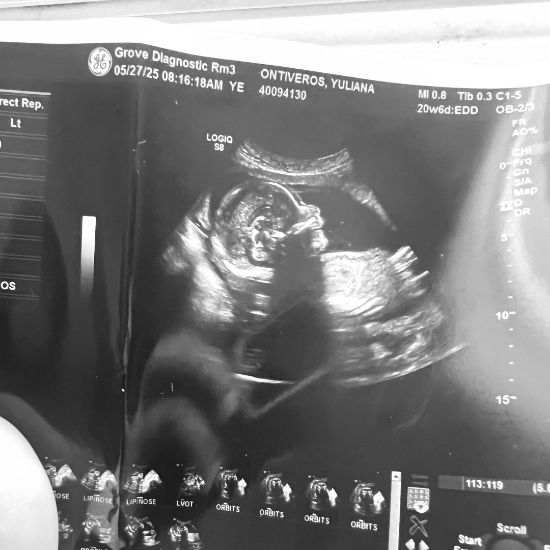 Photo shared by Yuliana for their Babylist baby registry.