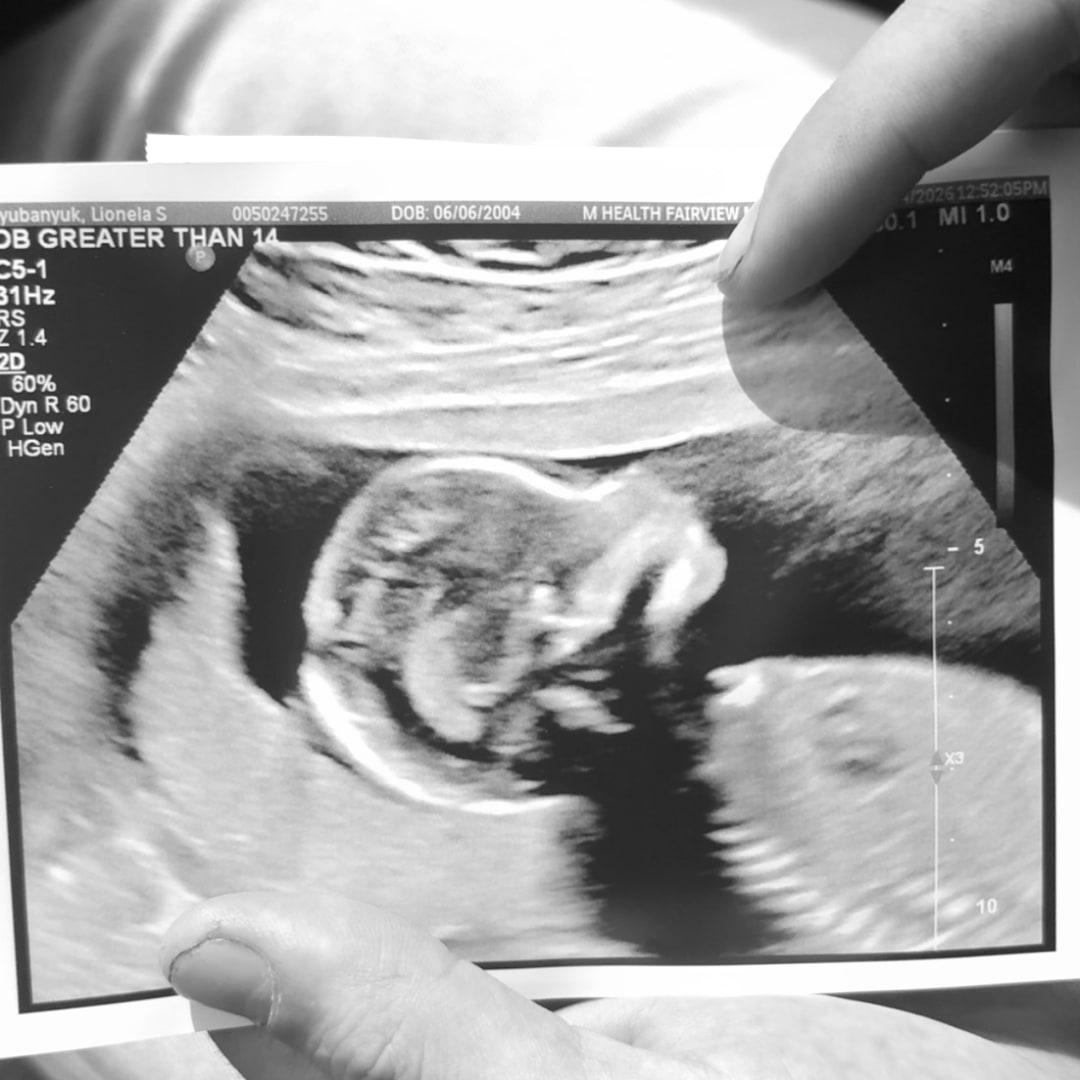 Photo shared by Lionela for their Babylist baby registry.