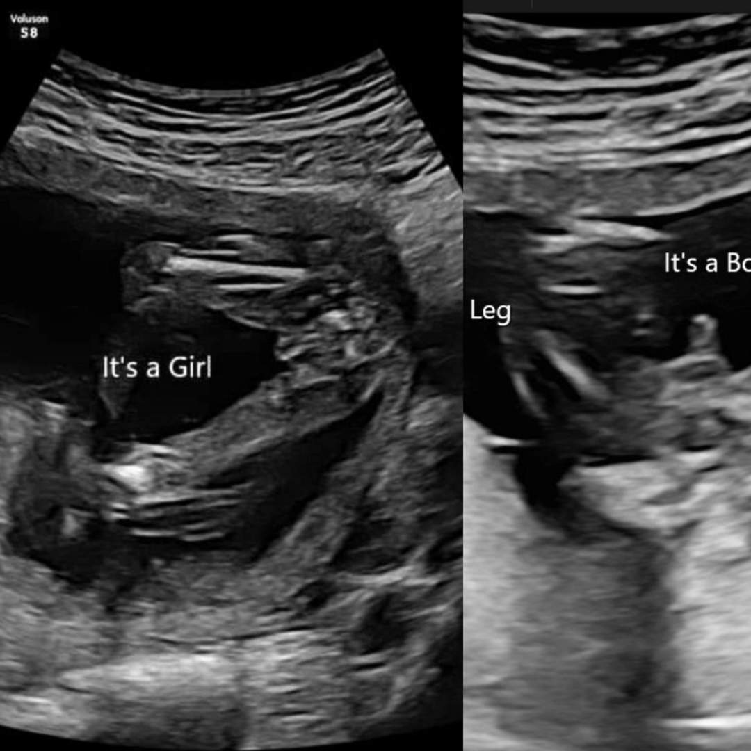 Photo shared by Anthony for their Babylist baby registry.