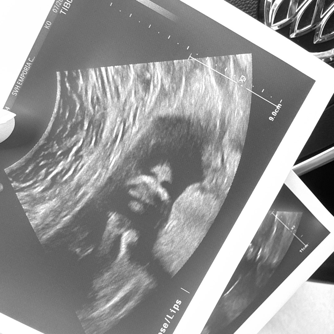 Photo shared by Brittany for their Babylist baby registry.
