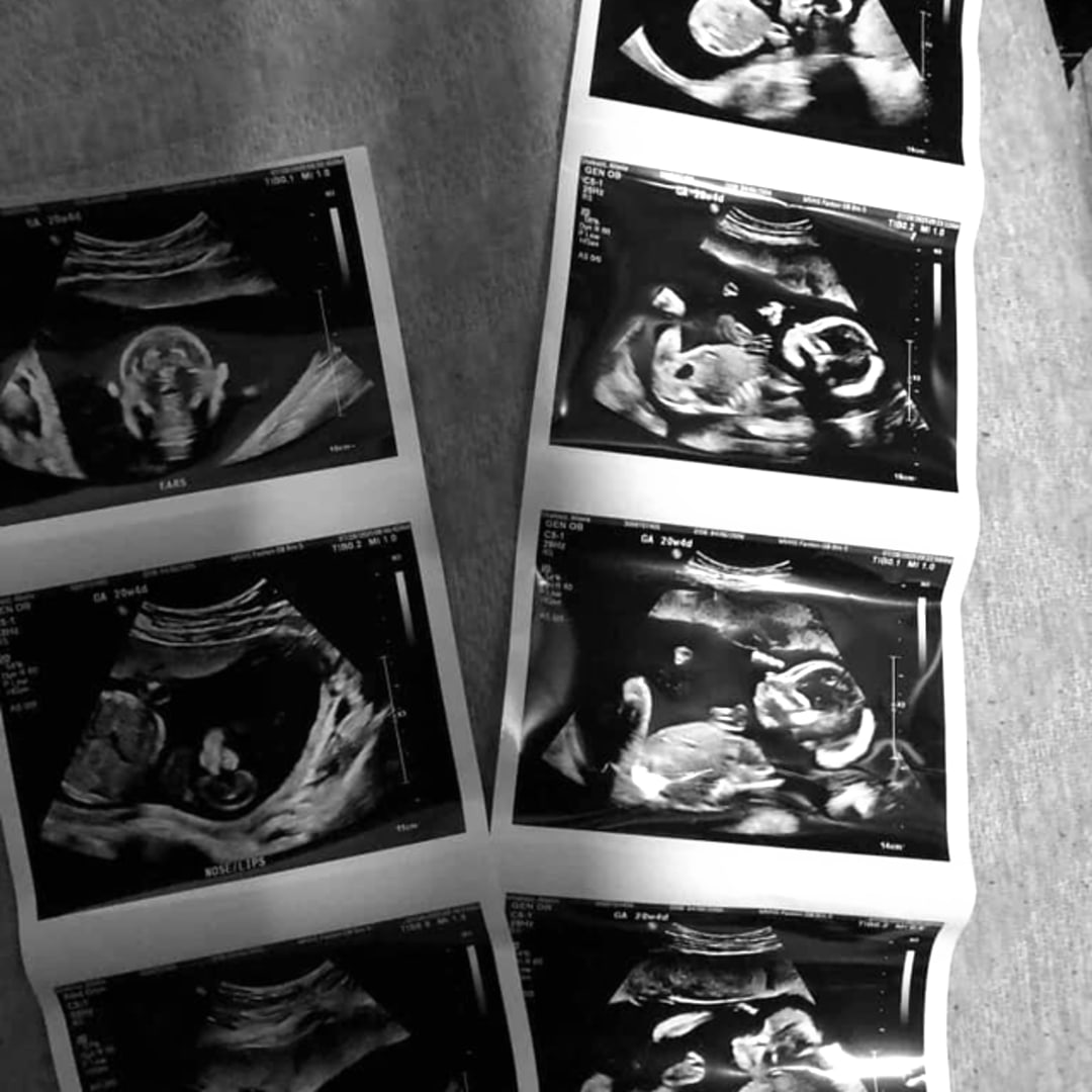 Photo shared by Aliasia for their Babylist baby registry.