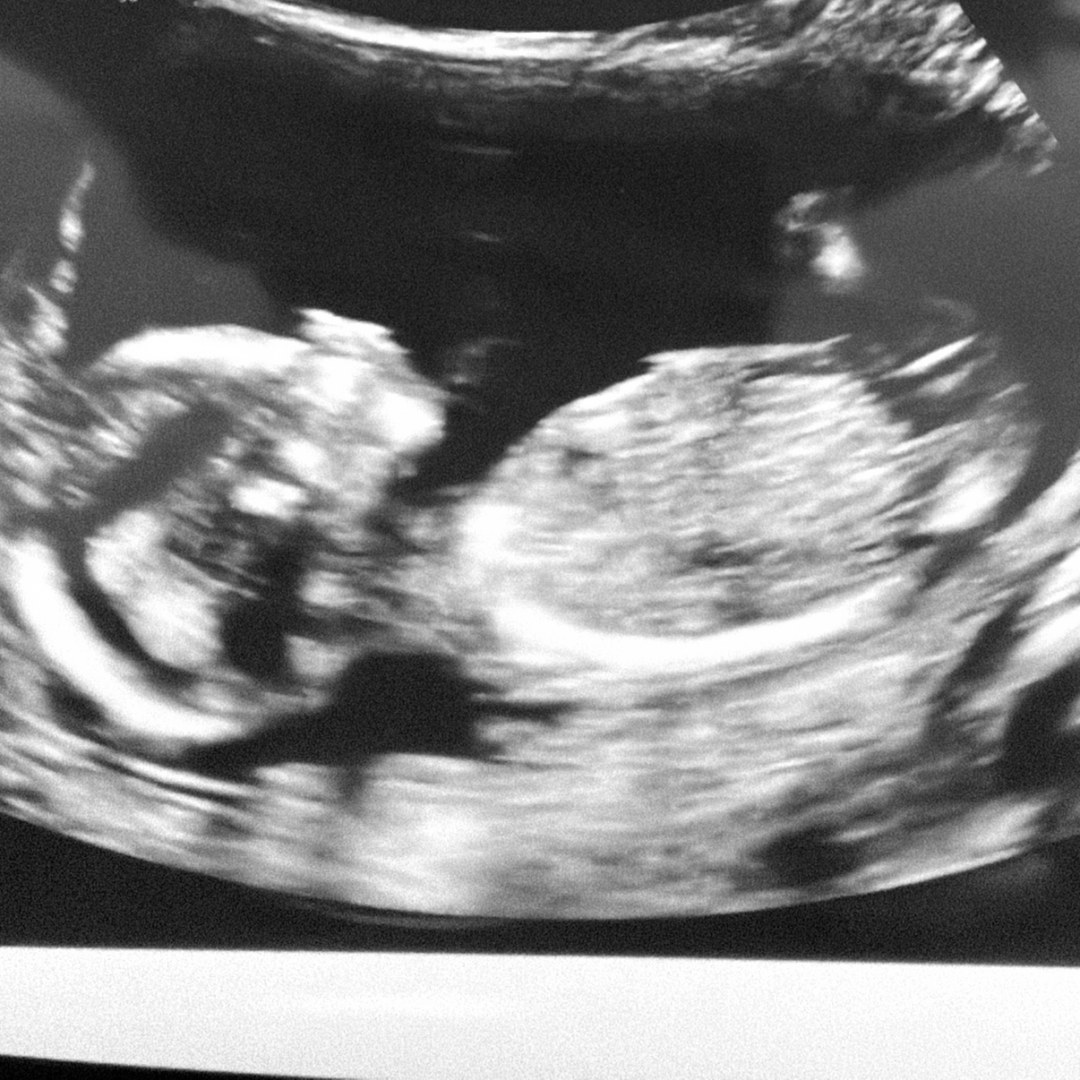 Photo shared by Stephanie for their Babylist baby registry.