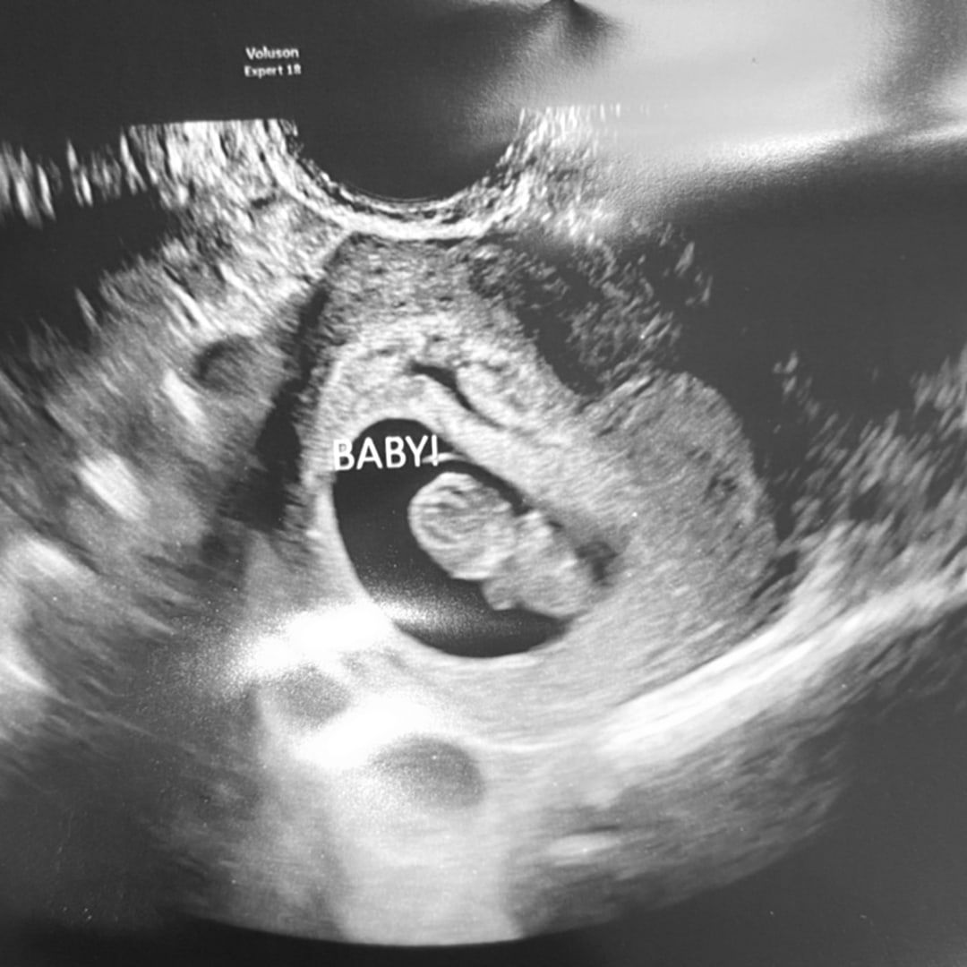 Photo shared by Destiny for their Babylist baby registry.