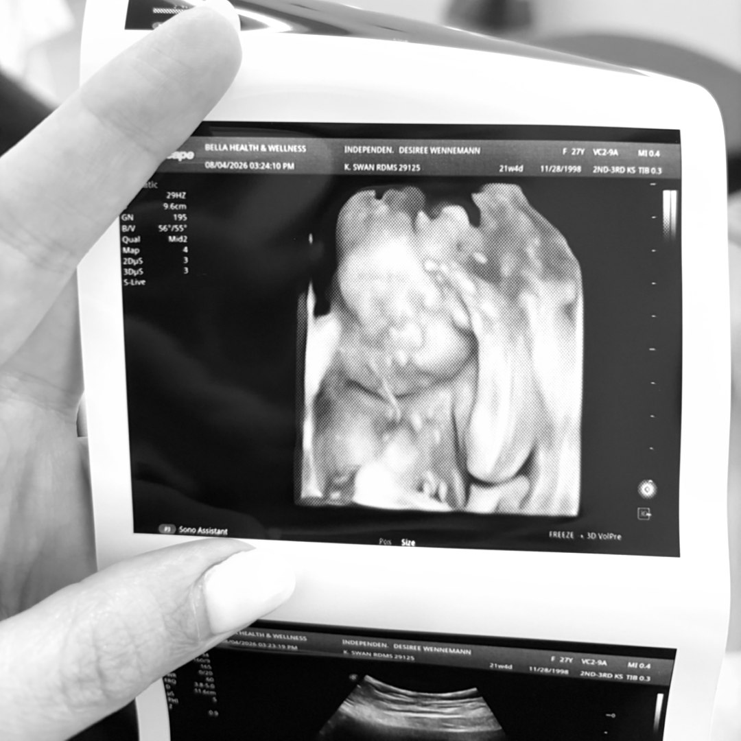 Photo shared by Desiree for their Babylist baby registry.
