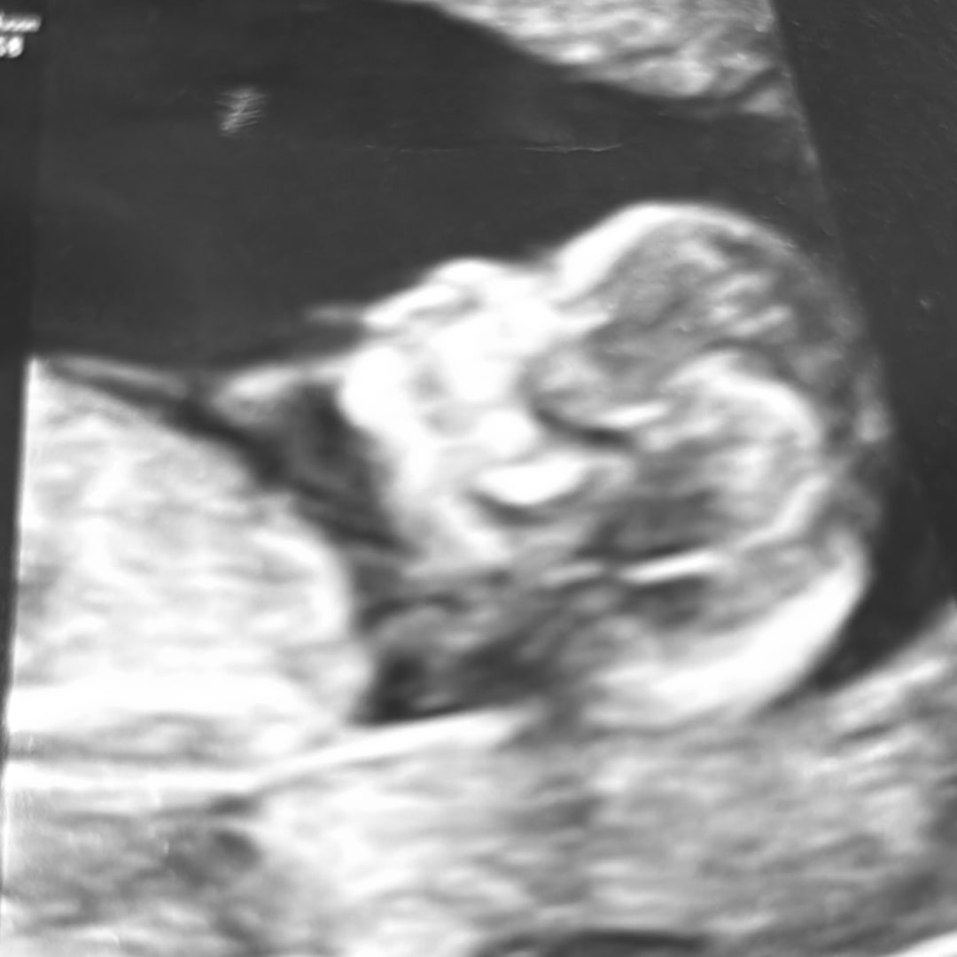 Photo shared by Alondra for their Babylist baby registry.