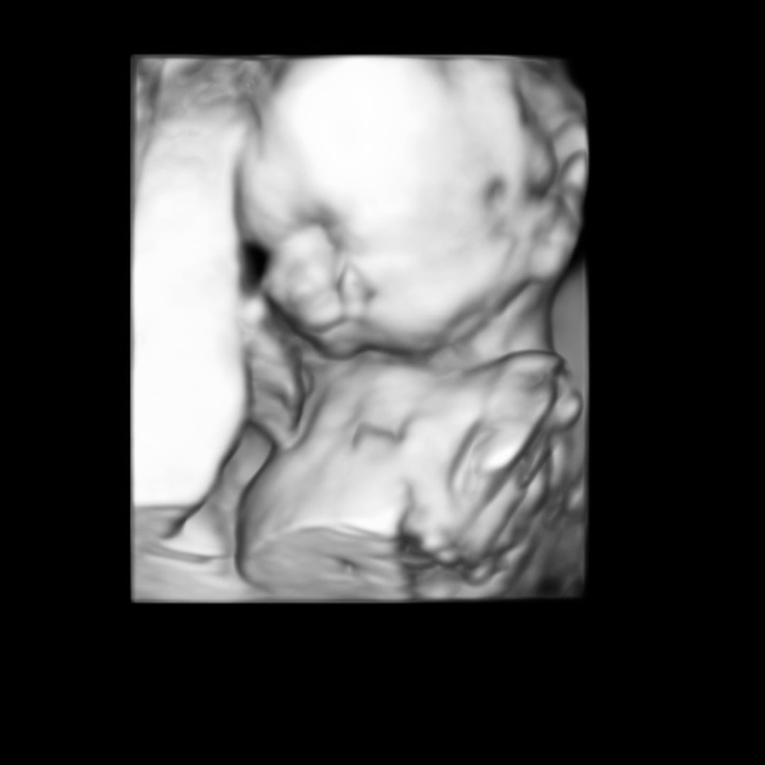 Photo shared by Caitlyn for their Babylist baby registry.