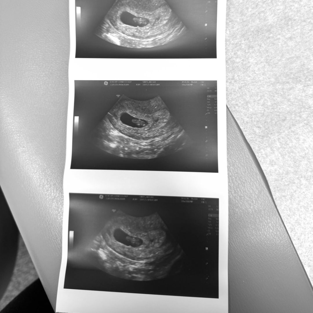 Photo shared by Abby for their Babylist baby registry.