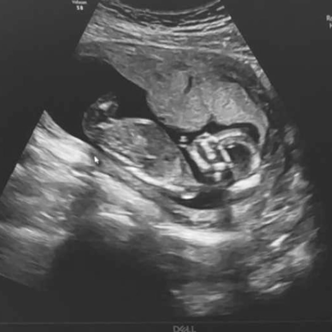 Photo shared by Ashley for their Babylist baby registry.