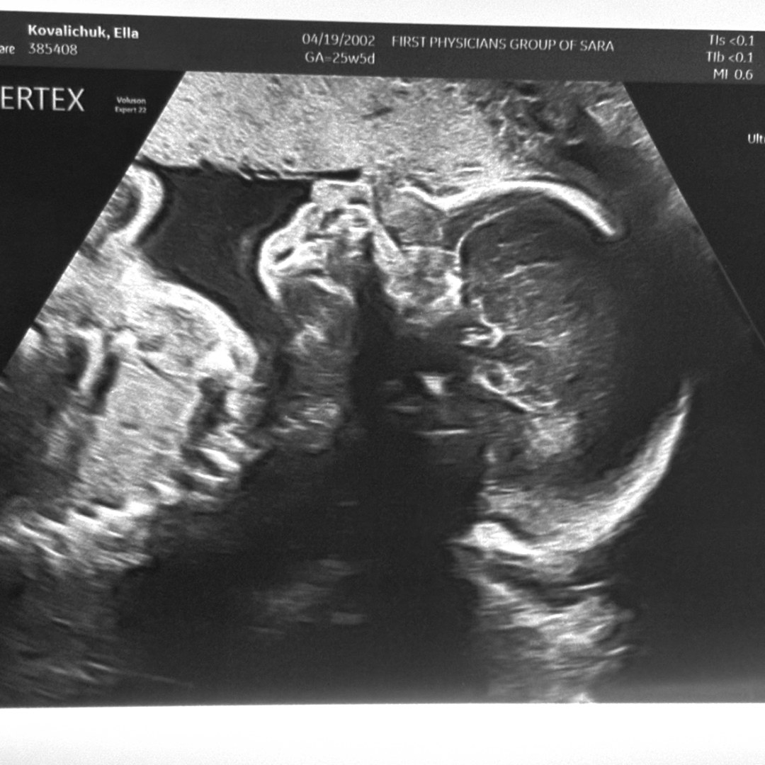 Photo shared by Ella for their Babylist baby registry.