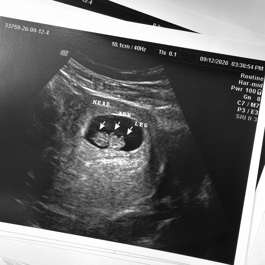 Photo shared by Alexa for their Babylist baby registry.
