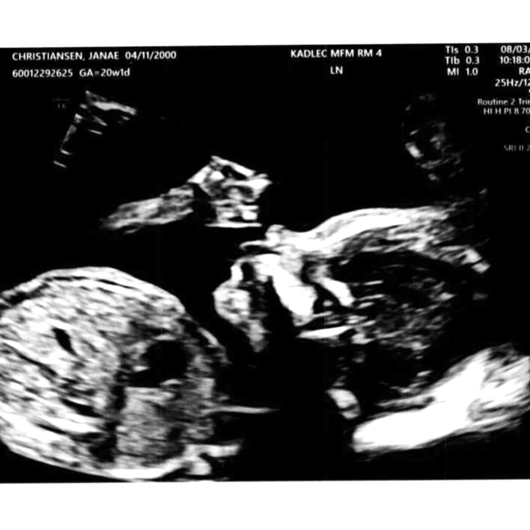 Photo shared by Janae for their Babylist baby registry.