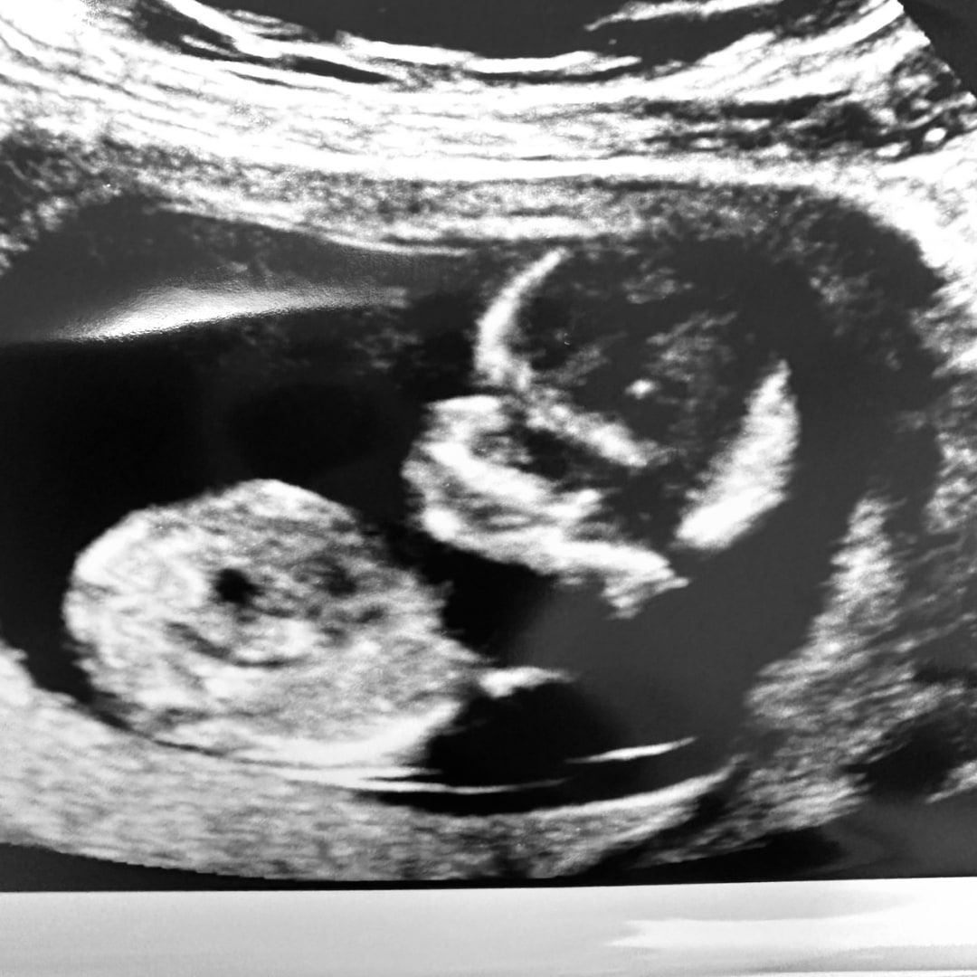 Photo shared by Michelle for their Babylist baby registry.