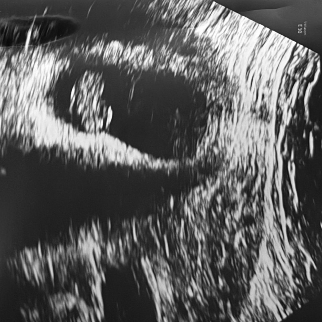 Photo shared by Brandi for their Babylist baby registry.