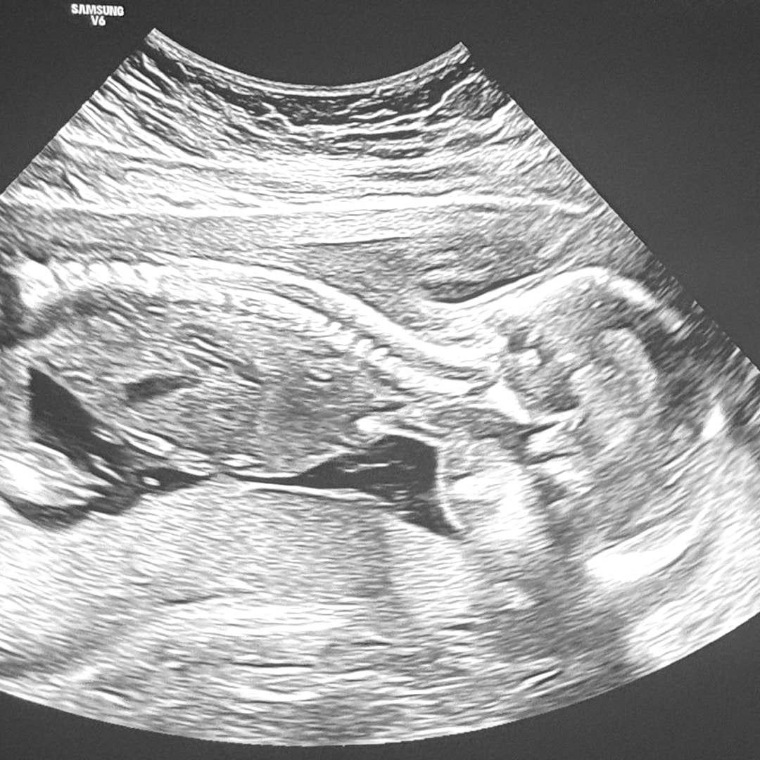 Photo shared by Yailin for their Babylist baby registry.