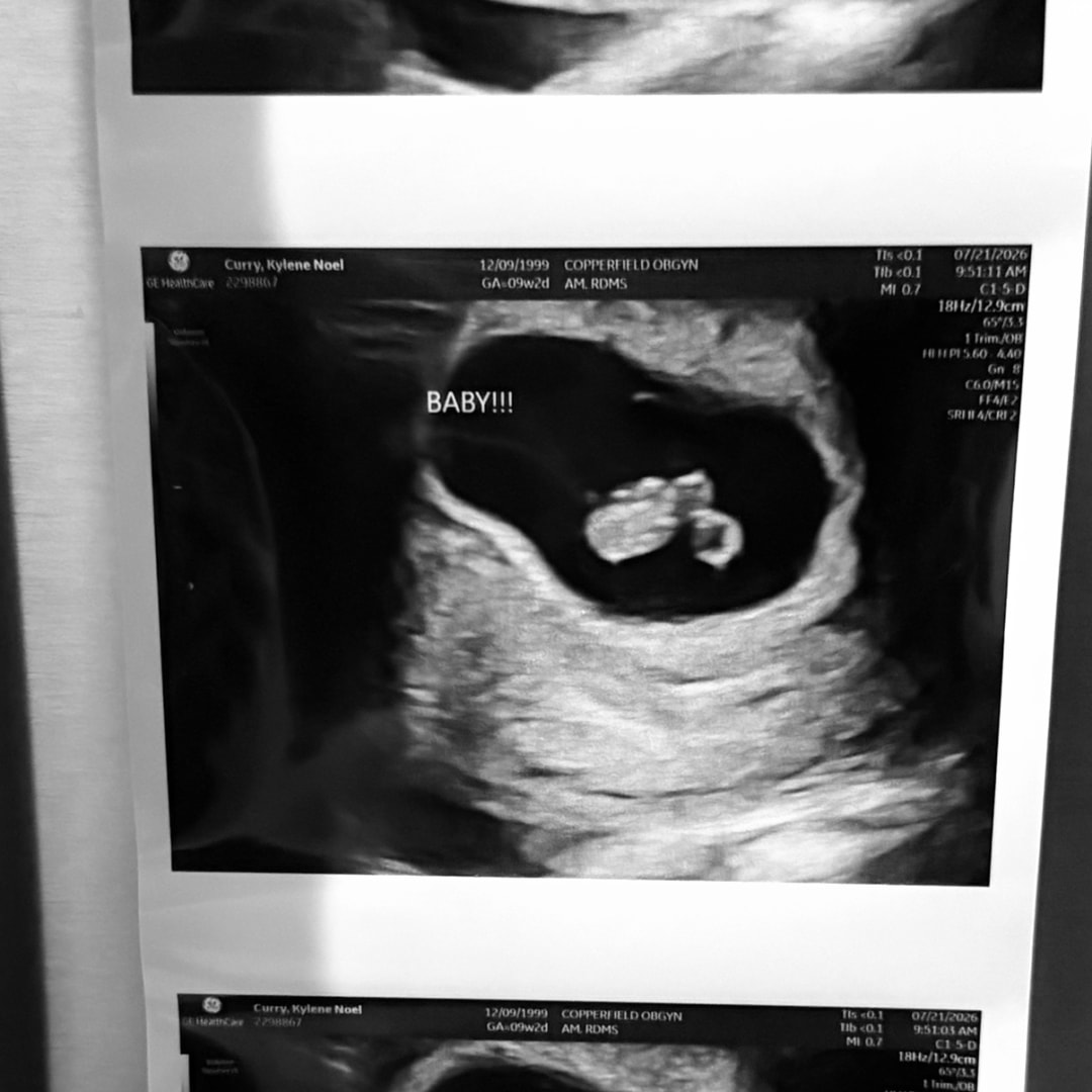 Photo shared by Kylene for their Babylist baby registry.