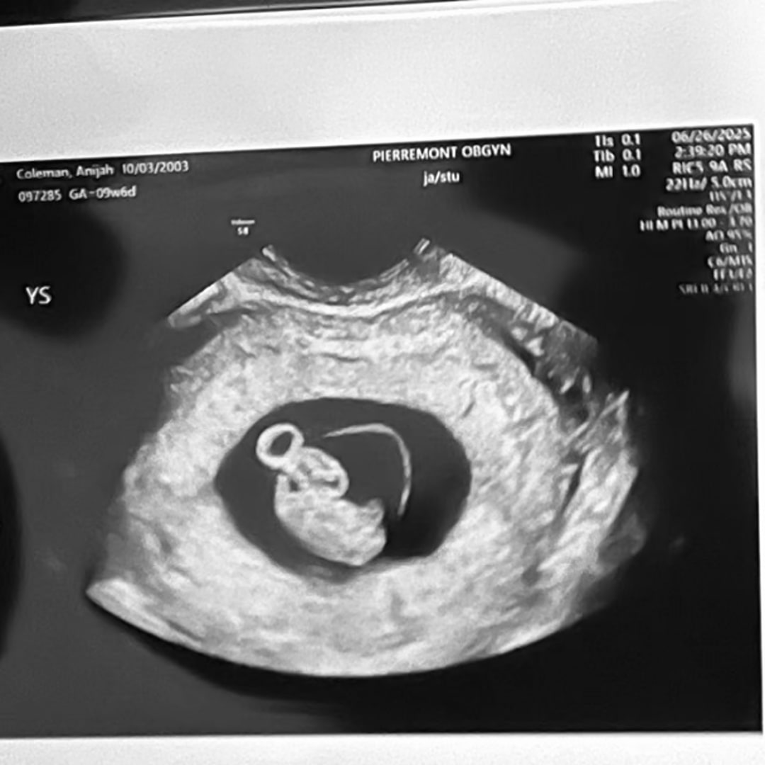Photo shared by Anijah for their Babylist baby registry.