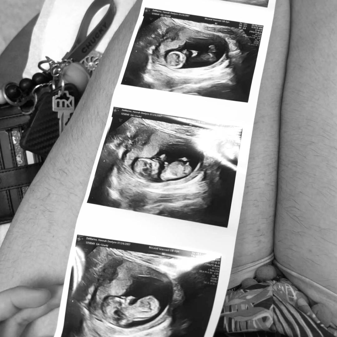 Photo shared by Hannah for their Babylist baby registry.