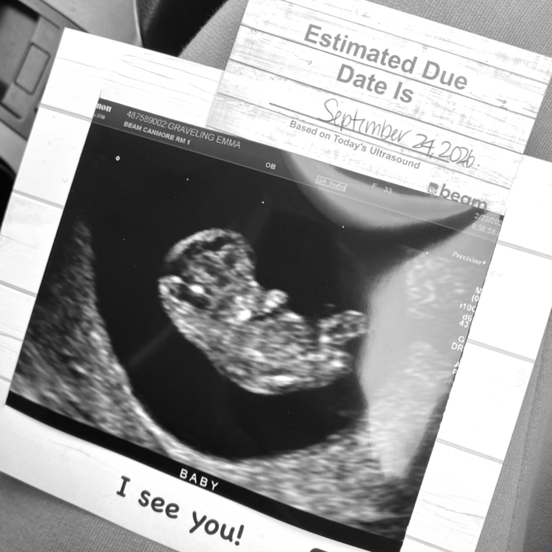 Photo shared by Emma for their Babylist baby registry.