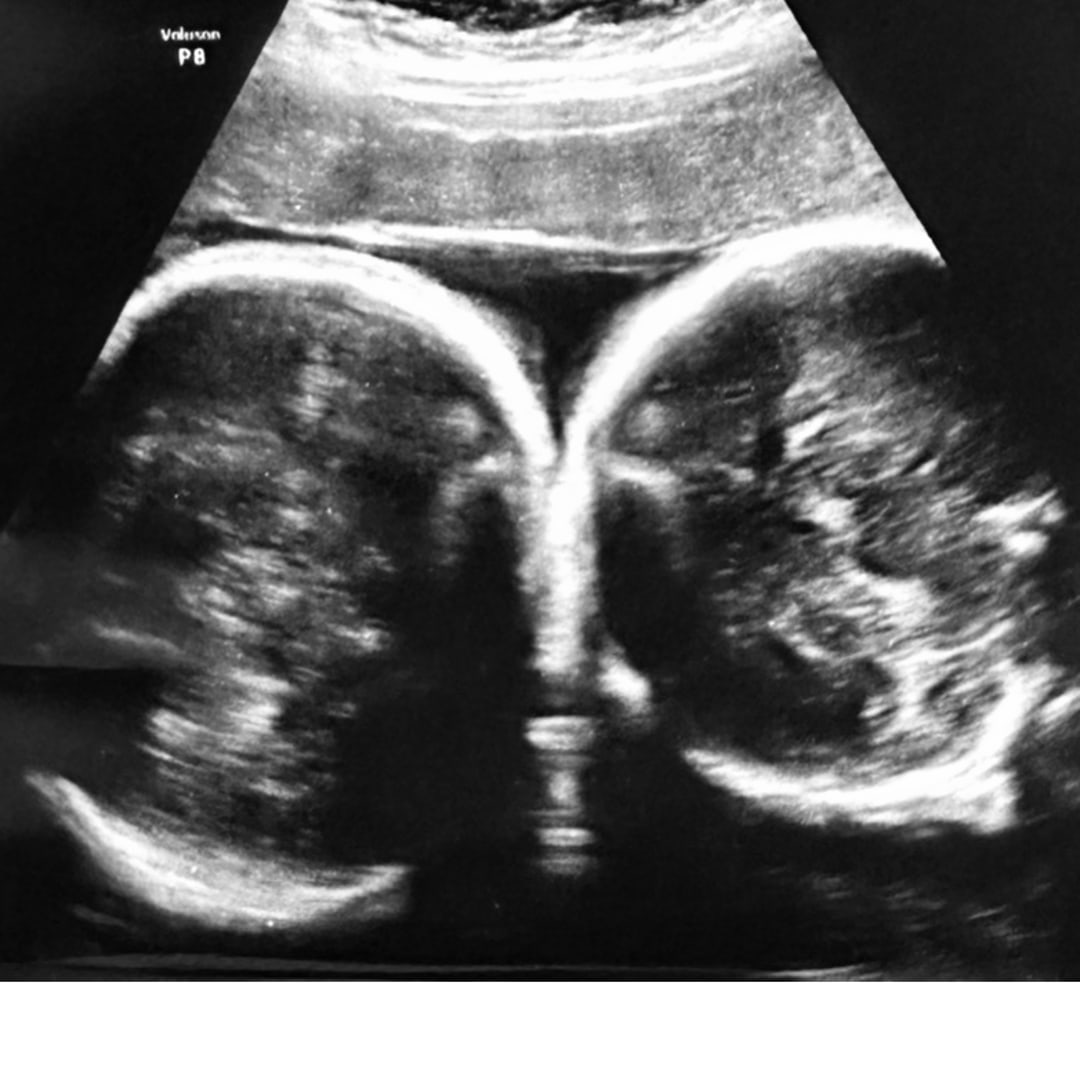Photo shared by Rachel for their Babylist baby registry.