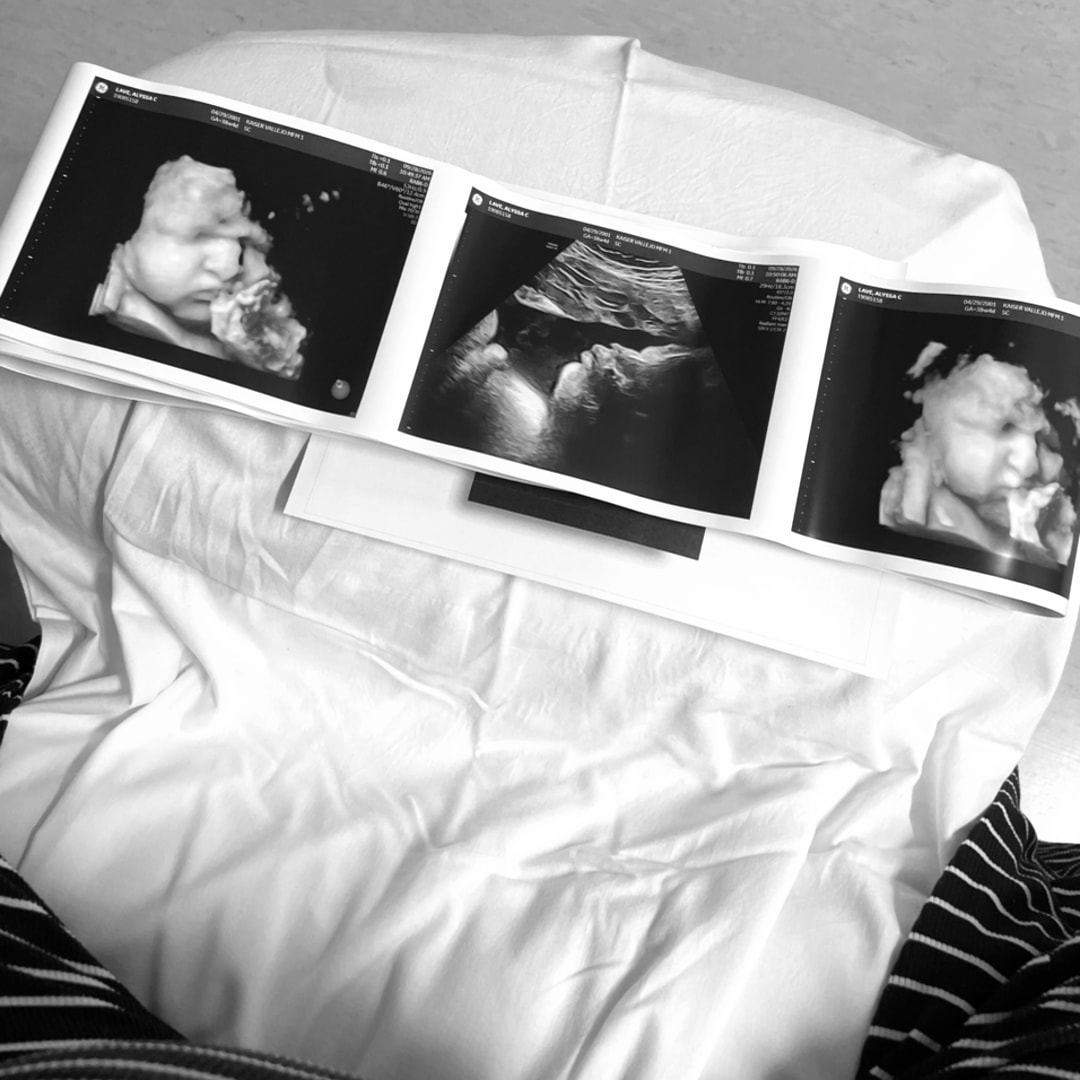 Photo shared by Alyssa for their Babylist baby registry.
