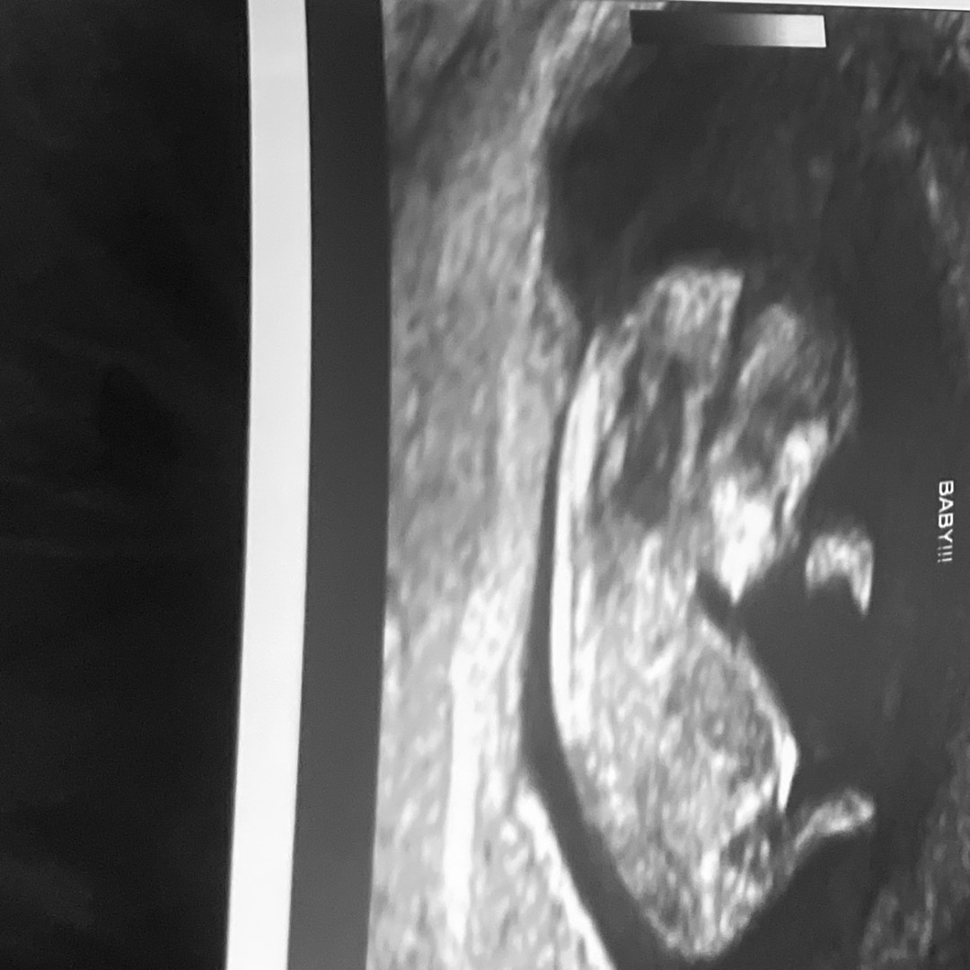 Photo shared by Mekyella for their Babylist baby registry.