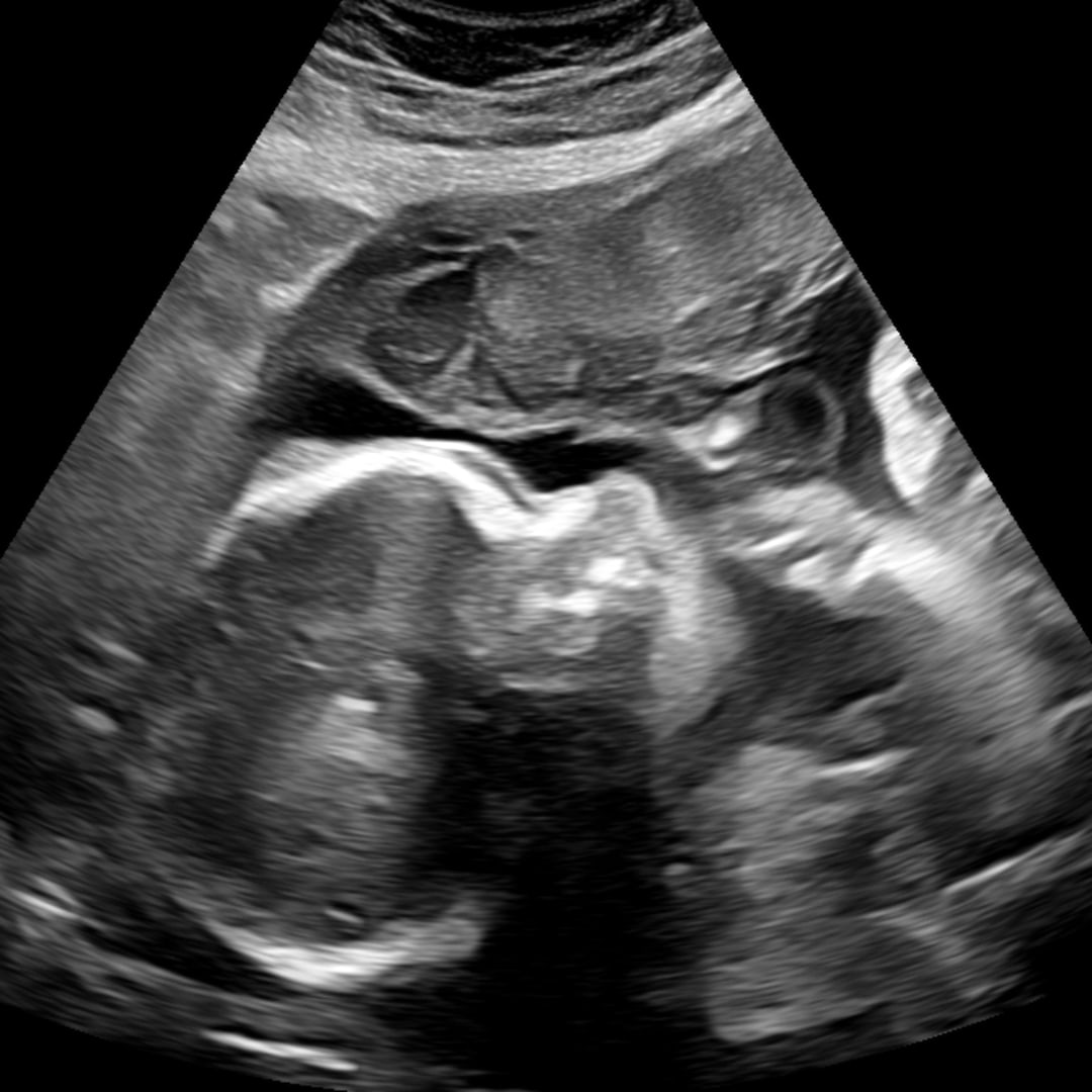 Photo shared by Jaylen for their Babylist baby registry.
