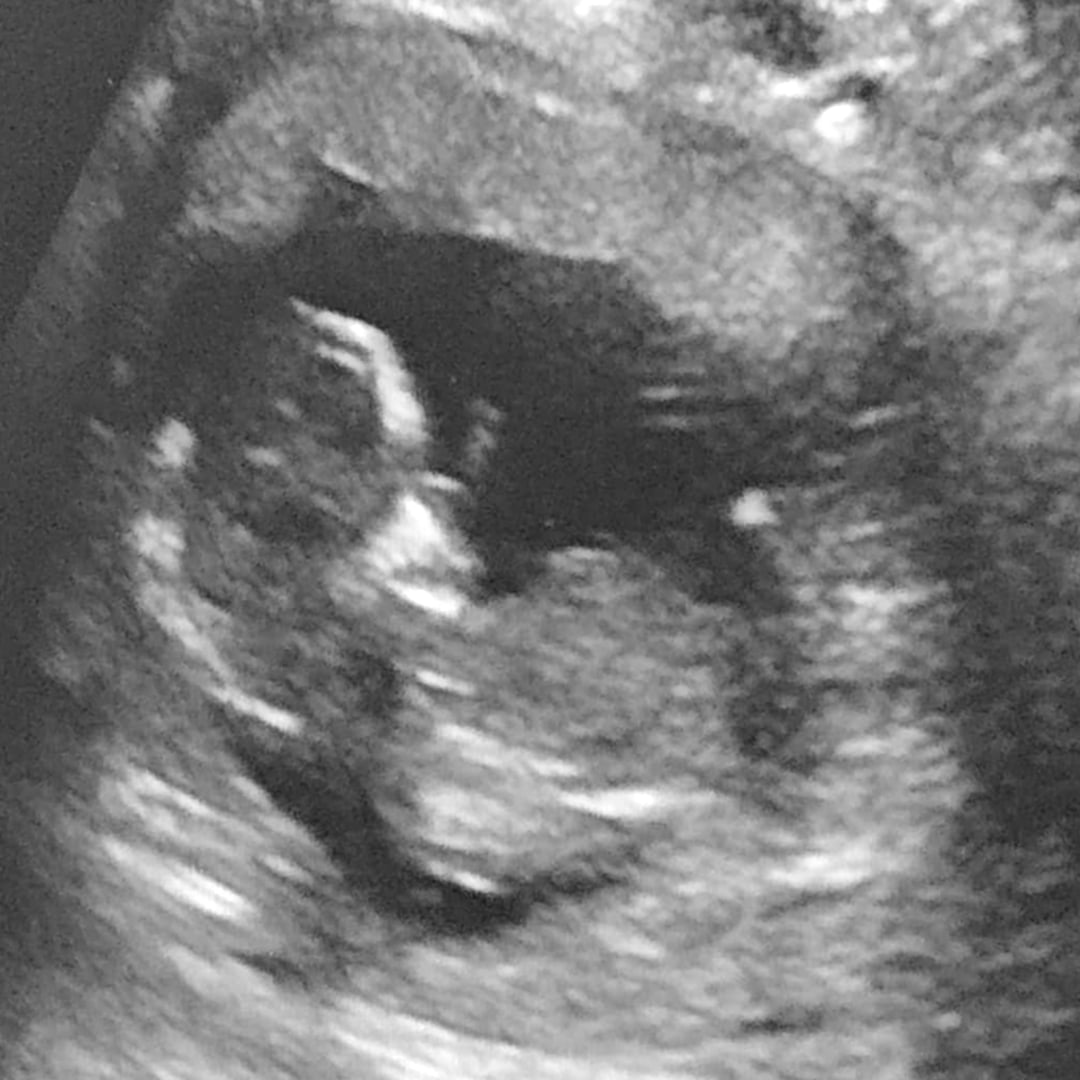 Photo shared by Jamielee for their Babylist baby registry.