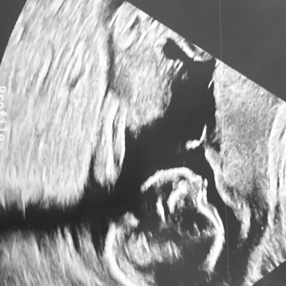 Photo shared by Mercedes for their Babylist baby registry.