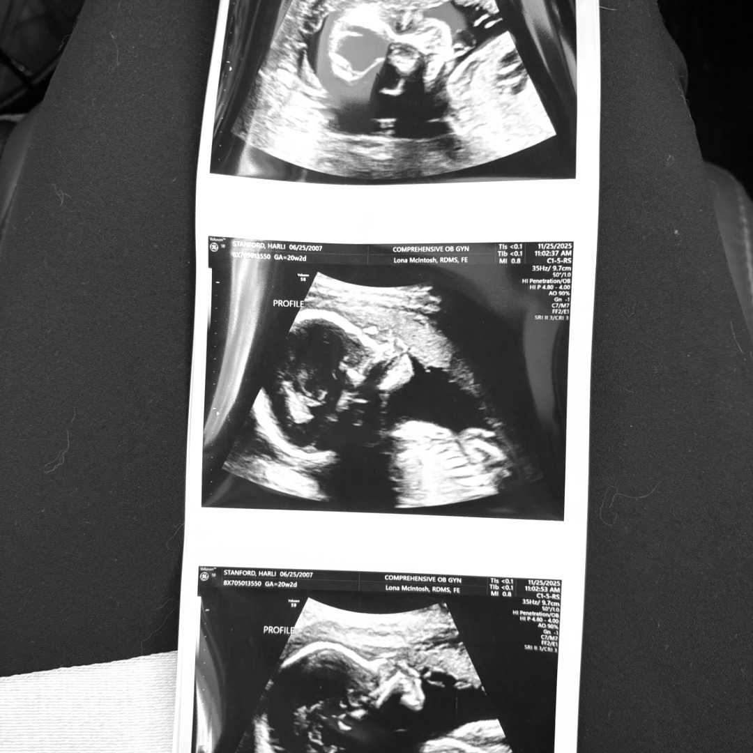 Photo shared by Harli for their Babylist baby registry.