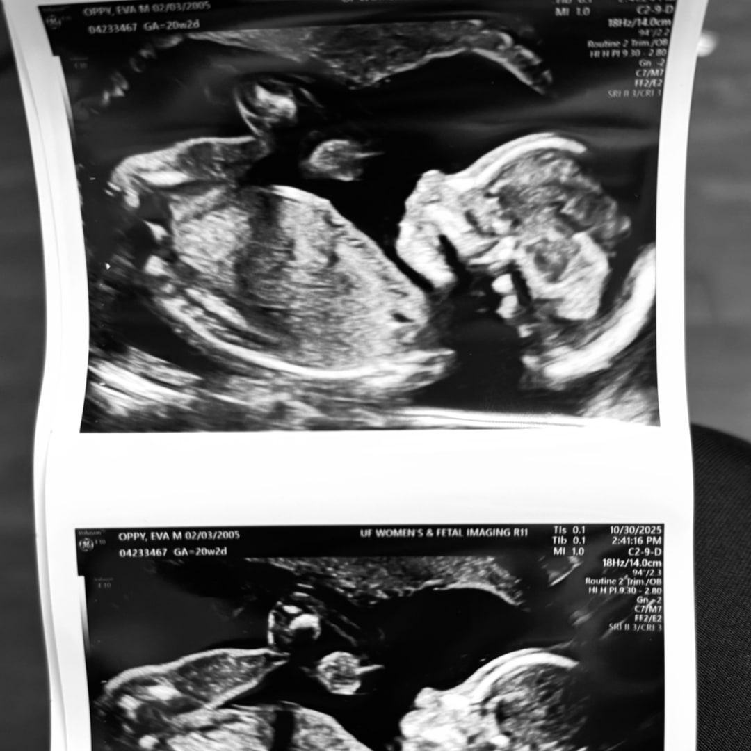 Photo shared by Eva for their Babylist baby registry.