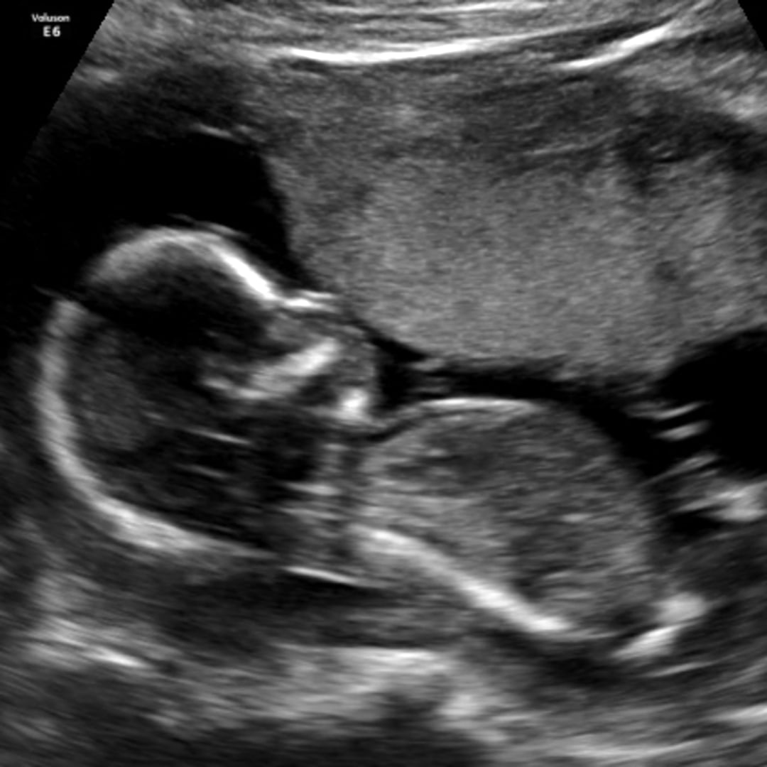 Photo shared by Cayti for their Babylist baby registry.