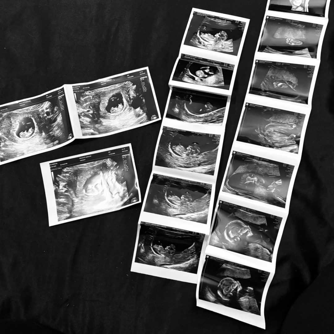 Photo shared by Addison for their Babylist baby registry.