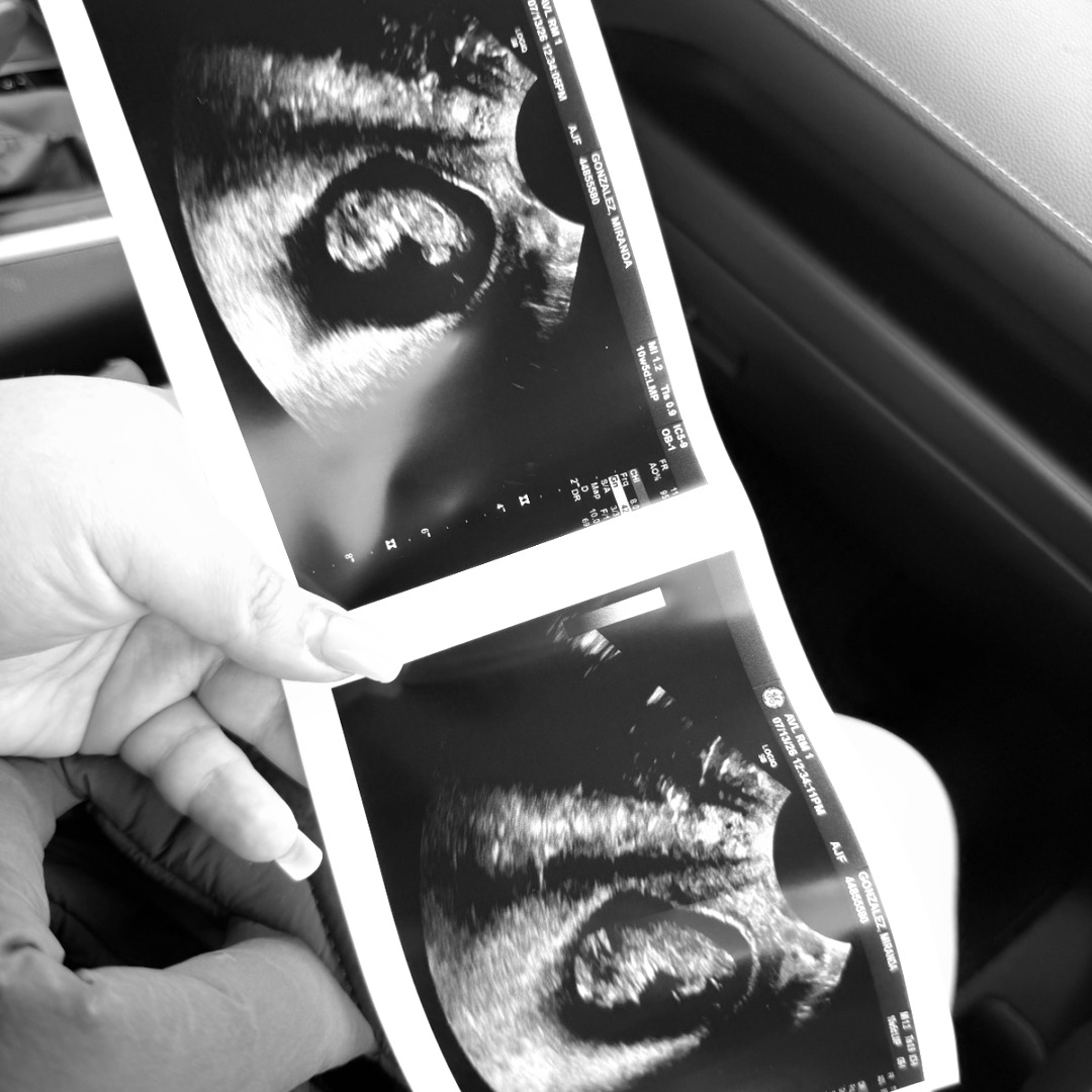 Photo shared by Miranda for their Babylist baby registry.